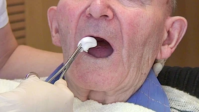 Beispiele: Zunge, Schleimhäute & Besonderheiten