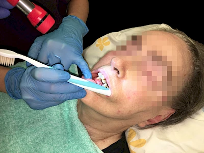 Taschenlampe zur optimalen Ausleuchtung so nah möglich an den Mund heranführen.