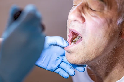 Taschenlampe zur optimalen Ausleuchtung so nah möglich an den Mund heranführen.