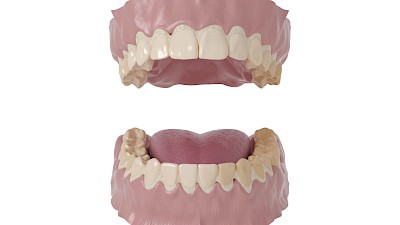 Wichtig ist, dass möglichst alle Zahnoberflächen geputzt werden. Ebenso sollten Prothesenauflageflächen und bei Bedarf die Zunge gereinigt werden.