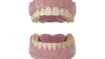 Wichtig ist, dass möglichst alle Zahnoberflächen geputzt werden. Ebenso sollten Prothesenauflageflächen und bei Bedarf die Zunge gereinigt werden.
