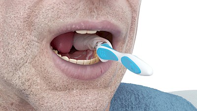 Zwischendurch Zahnpastaschaum und gelöste Beläge ausspucken lassen oder den Mund mit einer Kompresse auswischen.