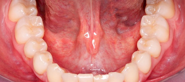 Anatomie Lippen, Schleimhäute & Speichel 