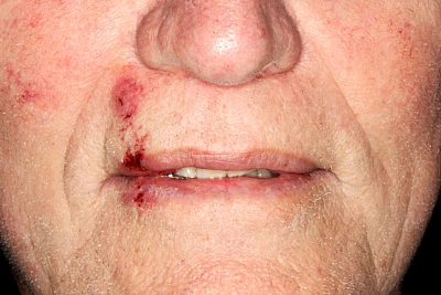 Beispiel: Zusammenstoß