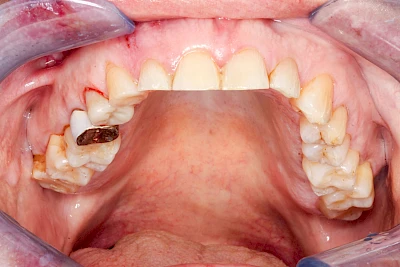 Beispiel: Zusammenstoß