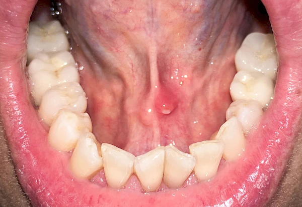 Gaumen, Wange & Zunge Besonderheiten: Sonstige Regionen
