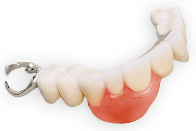 Beispiele: Lippen-Kiefer-Gaumenspalte