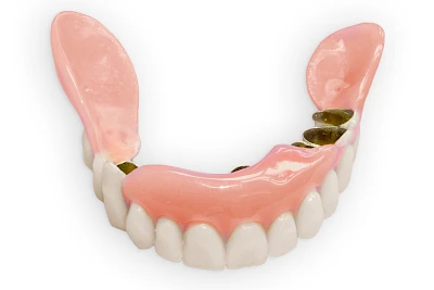 Beispiele: Lippen-Kiefer-Gaumenspalte