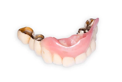 Beispiele: Lippen-Kiefer-Gaumenspalte