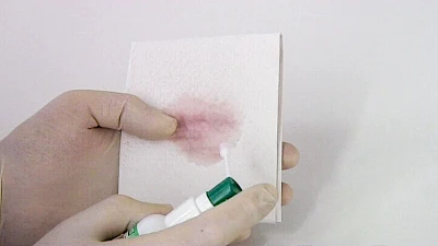 Beispiele: Zunge, Schleimhäute & Besonderheiten