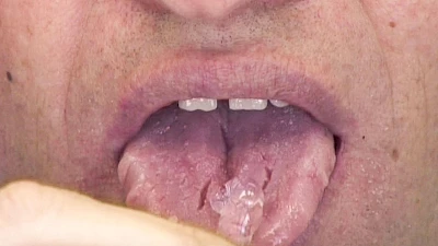 Beispiele: Zunge, Schleimhäute & Besonderheiten