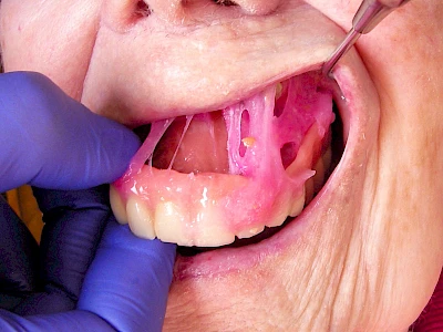 Beispiele: Haftcreme