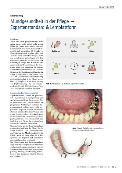 Öffentlichkeitsarbeit www.mund-pflege.net: Mundgesundheit in der Pflege – Expertenstandard & Lernplattform. Kongressbericht, in: Zahnärztlicher Gesundheitsdienst 1.24, S. 5-8