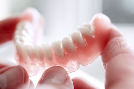 Zahnärztliche Versorgungen Füllung, Prothese, Schiene: Was ist das & wie sehen diese aus?