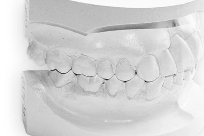 Beispiele: Schnarcherschiene