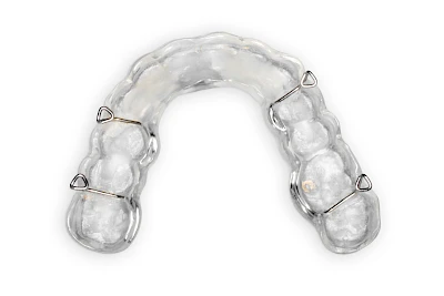 Beispiele: Abnutzung