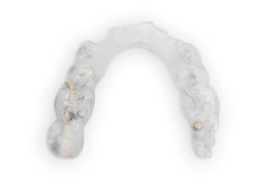 Beispiele: Bruch & Absplitterung