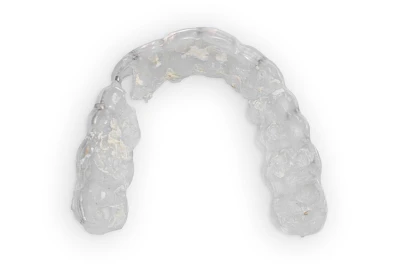 Beispiele: Bruch & Absplitterung