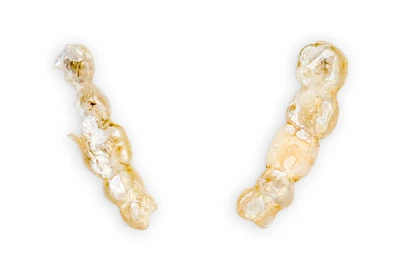 Beispiele: Bruch & Absplitterung