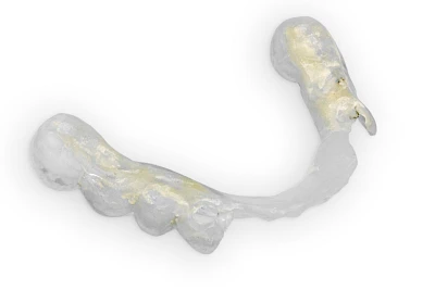 Beispiele: Bruch & Absplitterung