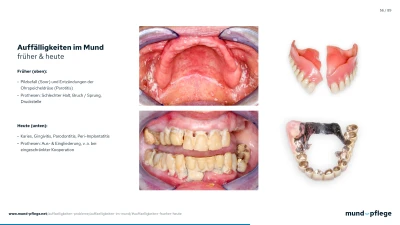 Presse Präsentation: Auffälligkeiten (.png)