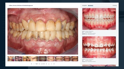 Presse Lernsituationen: Beispiel mit Anatomie (.png)