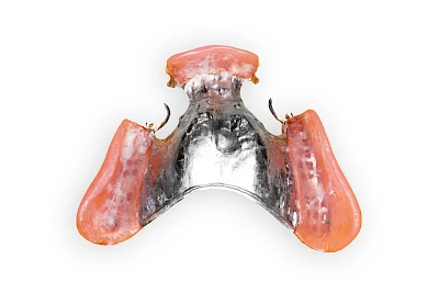 Beispiele: Prothesenstomatitis