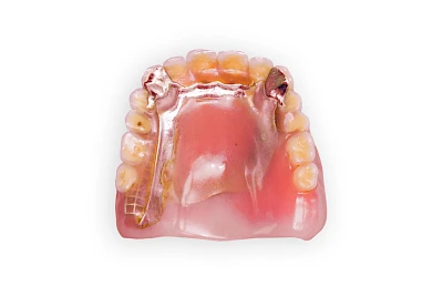 Beispiele: Prothesenstomatitis